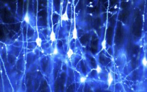 B0005204 Neurons in the brain Credit: Dr Jonathan Clarke. Wellcome Images images@wellcome.ac.uk http://wellcomeimages.org Pyramidal neurons forming a network in the brain. These are nerve cells from the cerebral cortex that have one large apical dendrite and several basal dendrites. Colour-enhanced light microscopy 2003 Published: - Copyrighted work available under Creative Commons by-nc-nd 4.0, see http://wellcomeimages.org/indexplus/page/Prices.html